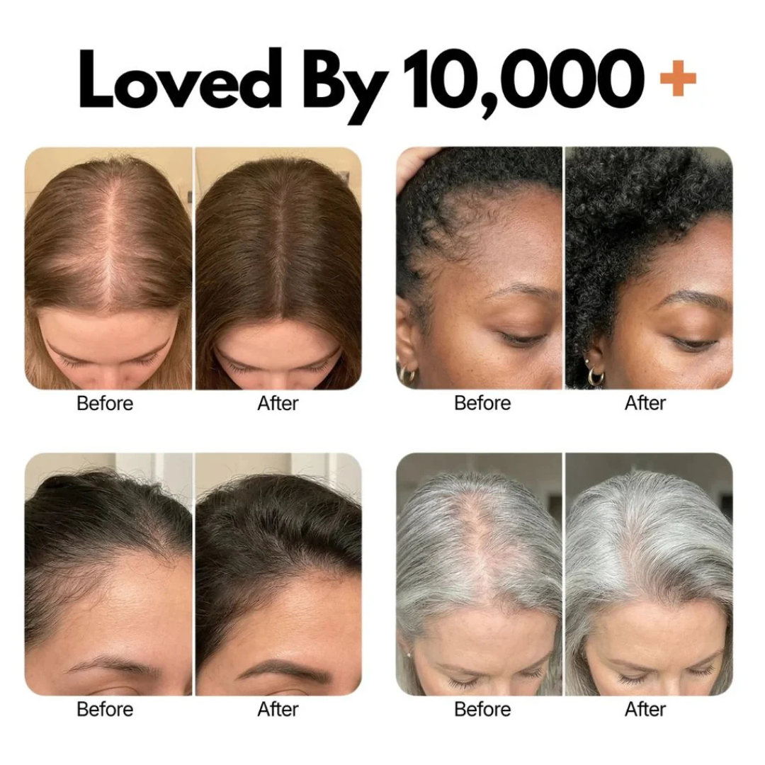 Nidoya® Hair Growth Serum