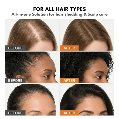 Nidoya® Hair Growth Serum